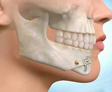 Cirugia Bucal Maxilofacial